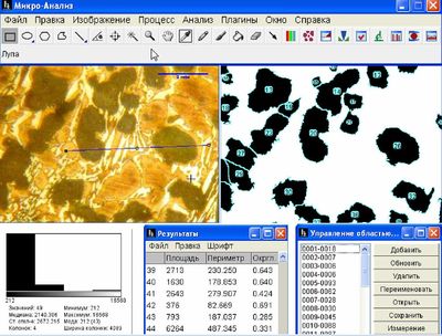 Программное обеспечение «Микро-Анализ»