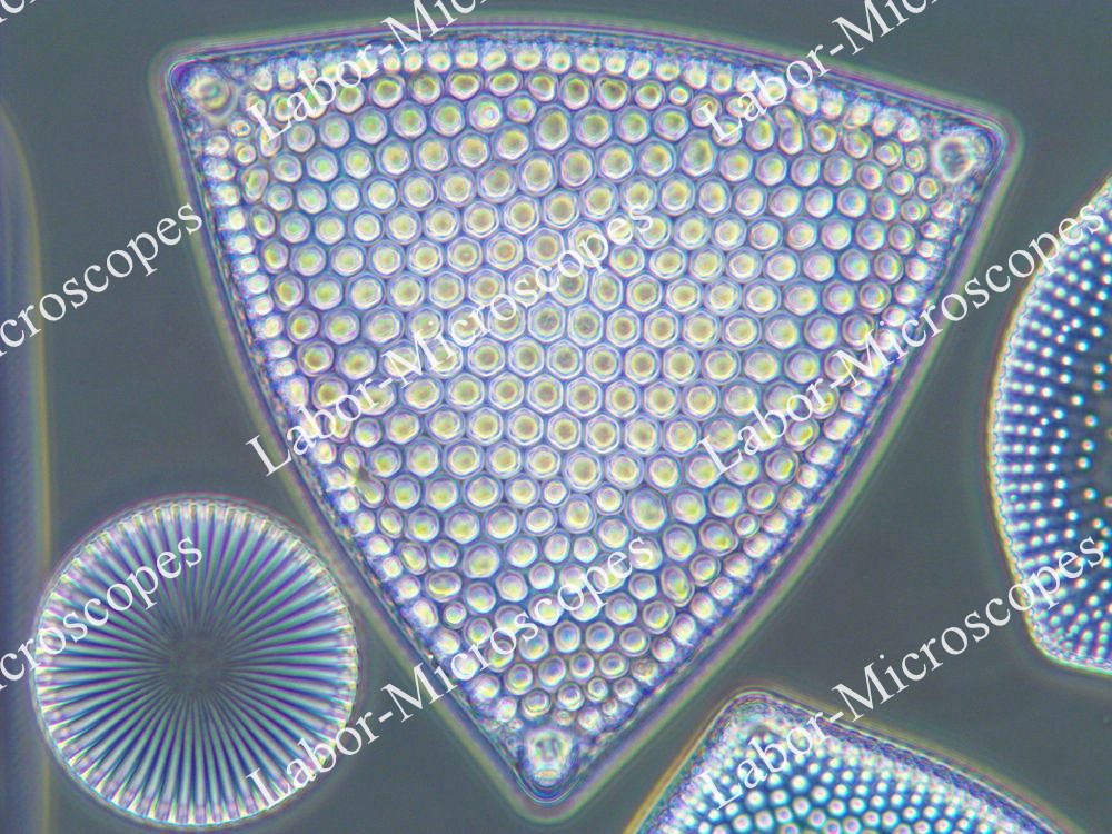 Фазовый контраст микроскопа ЛабоМед-2 Фазокон