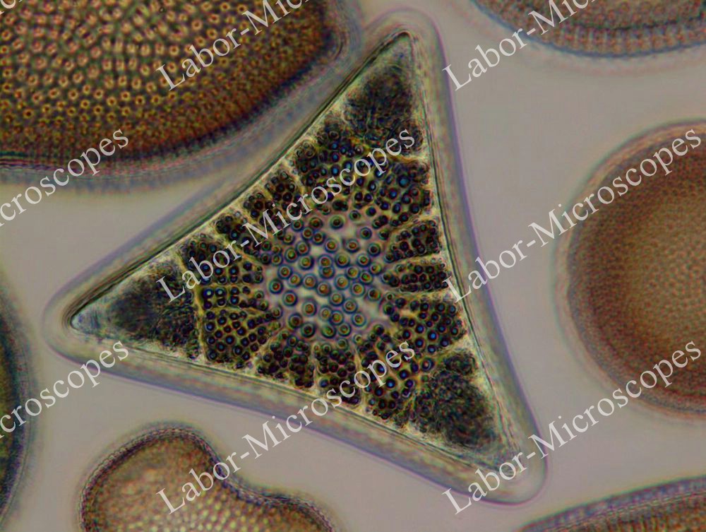Пример фазового контраста микроскопа ЛабоМед-2 Фазокон
