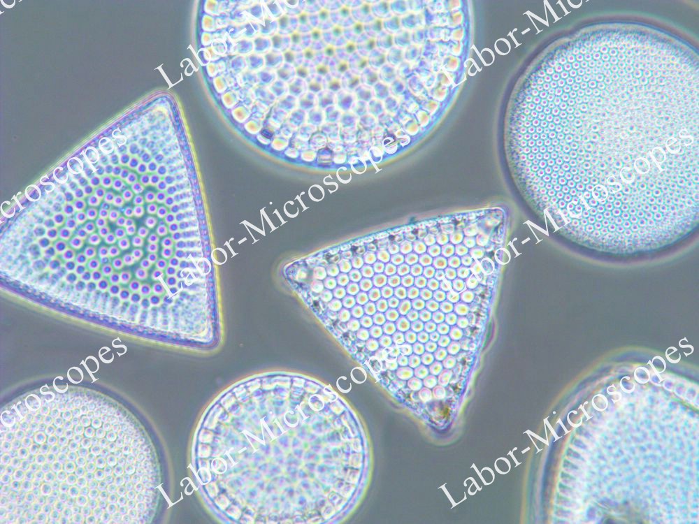 Фазовый контраст микроскопа ЛабоМед-2 Фазокон