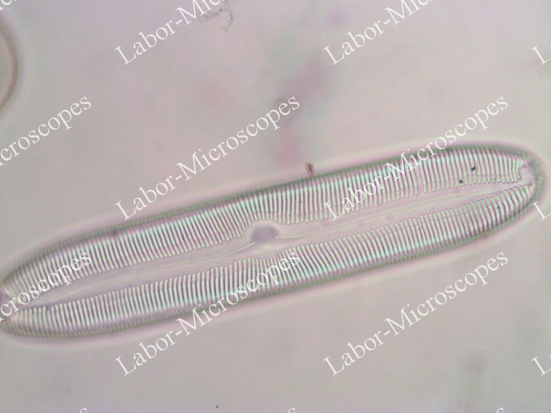 Пример фазового контраста микроскопа ЛабоМед-2 Фазокон
